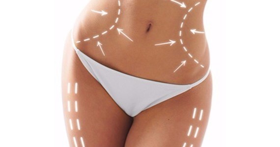 liposhape-contour-mulher-9kiu3