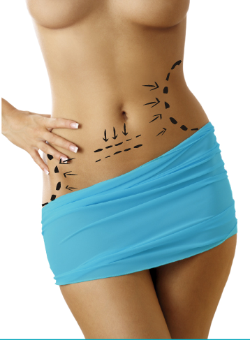 liposhape_contour_lipo_aspiracao_nao_invasiva_clinicayoucare_leiria